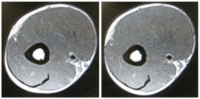 お腹の2枚のMRI画像